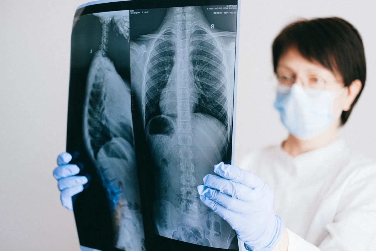 A doctor holding an X-ray result