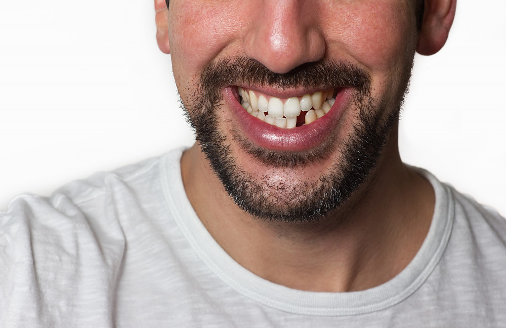 Close up on a man smiling while he is missing a tooth.