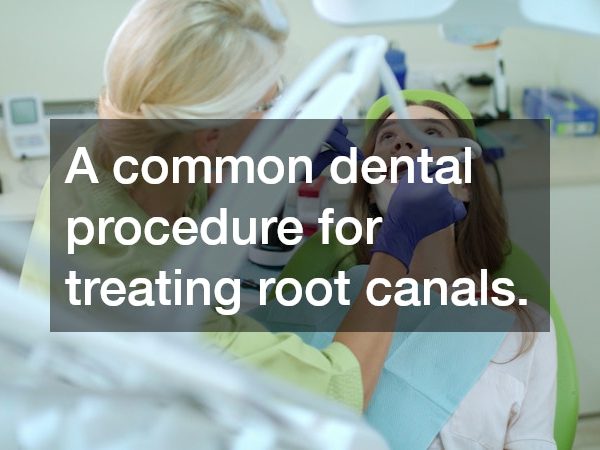 A common dental procedure for treating root canals.